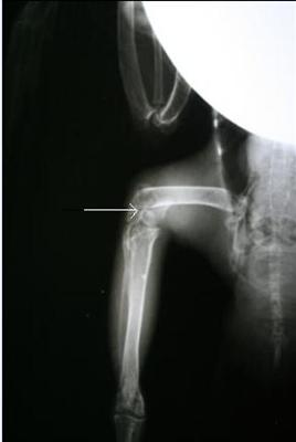 Radiograph fracture site